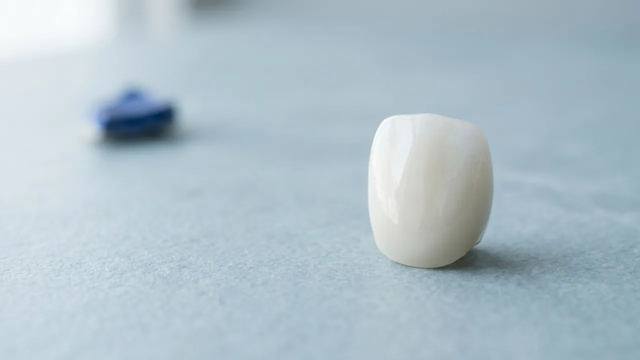 Cât costă un implant dentar și din ce se compune prețul?